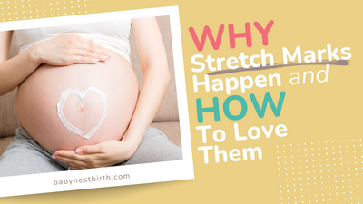 Why Stretch Marks Happen & How to Love Them